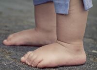 Опасность плоскостопия ног у детей. Или: «Родители, не идите на поводу у своих сыновей и дочерей».